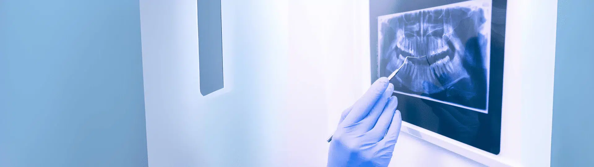 X-rays x-rays