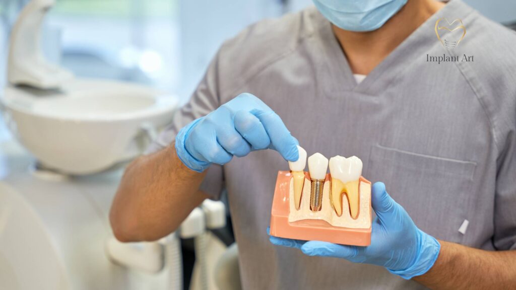 Dental Implants Brisbane