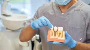 Dental Implants Brisbane