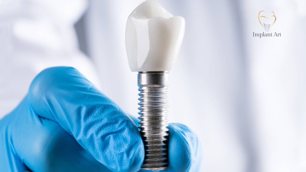 Dental Implants Brisbane