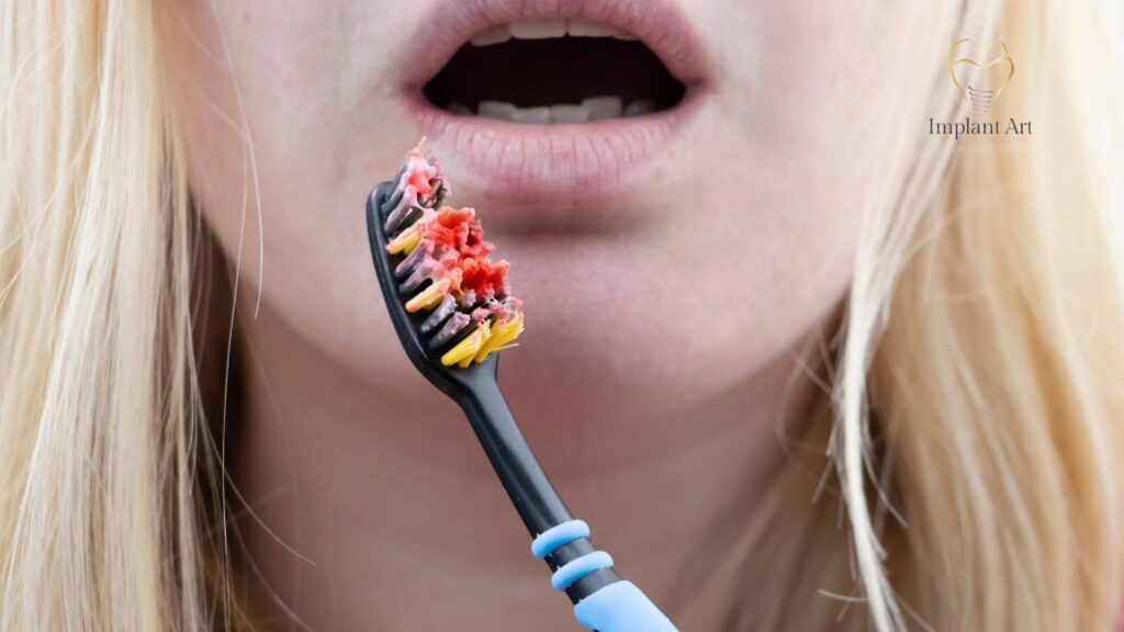 Bleeding during brushing