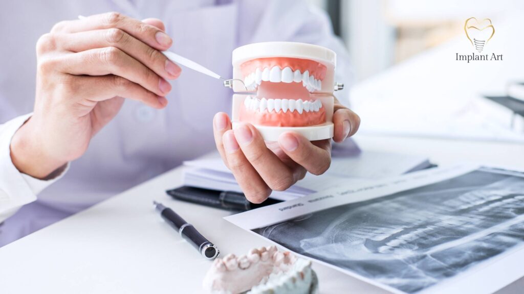Dental Bone Graft